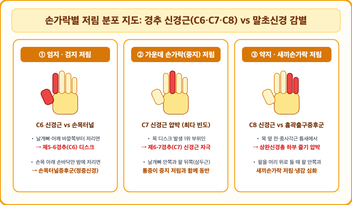 [그림 2] 손가락별 저림 분포 지도: 경추 신경근(C6·C7·C8) vs 흉곽출구증후군 vs 손목터널증후군 비교